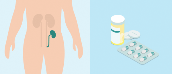 Andere behandelopties voor chronische nierziekte (CKD)